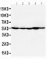 Anti-HDAC2 Antibody