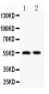 Anti-HDAC2 Antibody