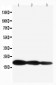 Anti-IL-1 beta Antibody