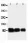 Anti-IL-8 Antibody