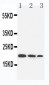 Anti-IL-10 Antibody