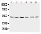 Anti-Presenilin 2 Antibody