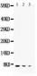 Anti-TGF Alpha Antibody