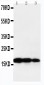 Anti-TNF Beta Antibody