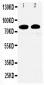 Anti-Calpain 1 Antibody