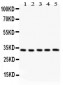 Anti-HSD11B1 Antibody