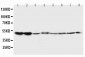 Anti-5HT2A Receptor Antibody