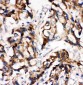 Anti-MEK1 Antibody