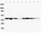 Anti-MEK3 Antibody