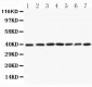 Anti-MEK3 Antibody