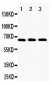 Anti-RANK Antibody