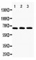 Anti-RANK Antibody