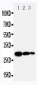 Anti-TIMP-1 Antibody