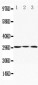 Anti-ApolipoProtein D Antibody