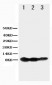 Anti-TNFRSF13C/BAFFR Antibody