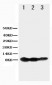 Anti-TNFRSF13C/BAFFR Antibody