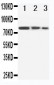 Anti-CD105 Antibody