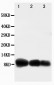 Anti-CXCL10/IP-10 Antibody