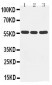 Anti-Cytochrome P450 2D6 Antibody