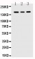 Anti-VEGFR1/FLT1 Antibody