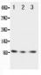 Anti-Fractalkine/CX3CL1 Antibody