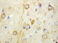 Anti-GAD65 Antibody