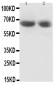 Anti-GAD65 Antibody