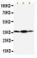 Anti-Podoplanin/gp36 Antibody