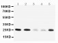 Anti-Pleiotrophin Antibody