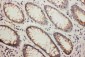 Anti-NDRG1 Antibody