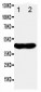 Anti-NDRG1 Antibody