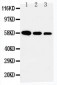 Anti-Fetuin A Antibody