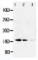 Anti-Galectin-1 Antibody