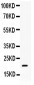 Anti-BCL2L2 Antibody