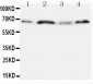 Anti-OPN Antibody