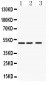 Anti-ANGPTL4 Antibody