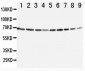 Anti-Annexin VI Antibody