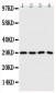 Anti-CA3 Antibody