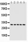 Anti-Caspase-6(P18) Antibody