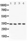 Anti-Caspase-7(P11) Antibody
