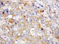 Anti-PF4 Antibody