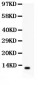 Anti-Beta Defensin 1 Antibody