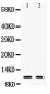 Anti-Eotaxin 3 Antibody