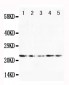 Anti-FGF10 Antibody