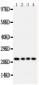 Anti-FGF22 Antibody