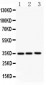 Anti-GM-CSF Antibody