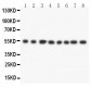 Anti-DLD Antibody