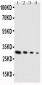 Anti-GDNF Antibody