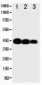Anti-IL-12(p40) Antibody