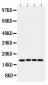 Anti-survivin Antibody